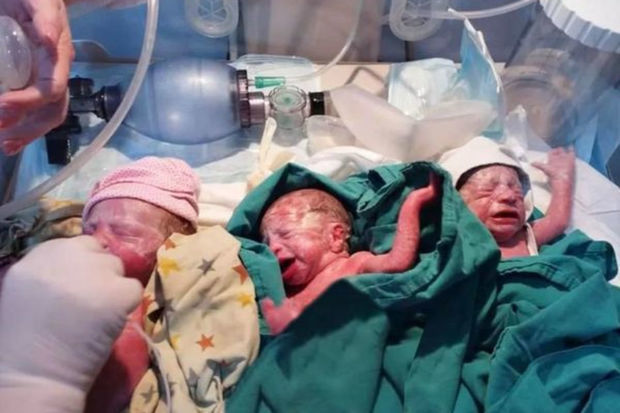 В Баку одна из двух заразившихся COVID-19 беременных женщин родила тройню, другая - четверняшек