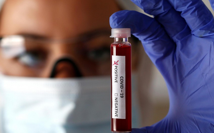 COVID-19-a yoluxma rəqəmlərinin artmasının əsas səbəbi məlum olub