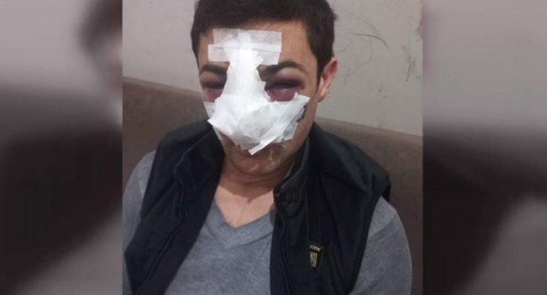 Bakıda avtobus sürücüsünün döyülməsinin ANBAAN VİDEOSU