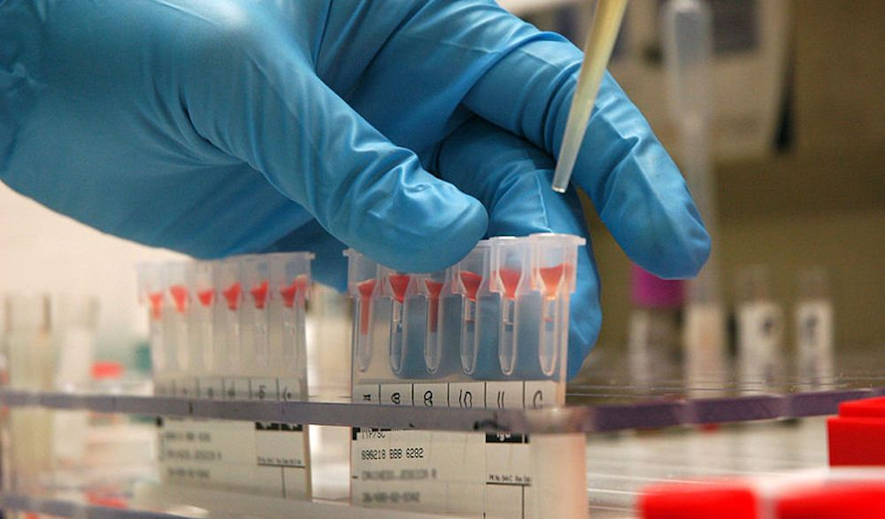 COVID-19-a yoluxmanın əsas artma səbəbi məlum oldu