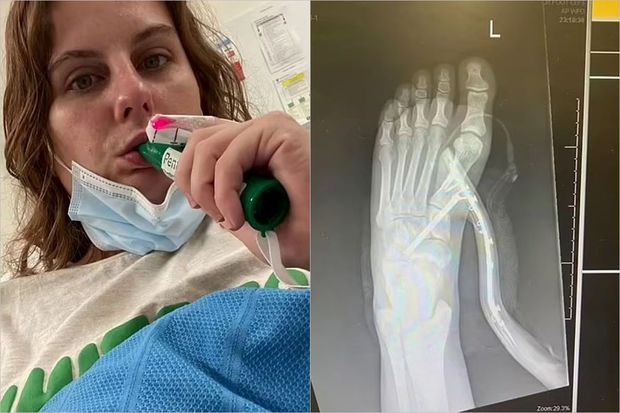 Женщина пронзила ногу каблуком, убегая от паука - ФОТО/ВИДЕО