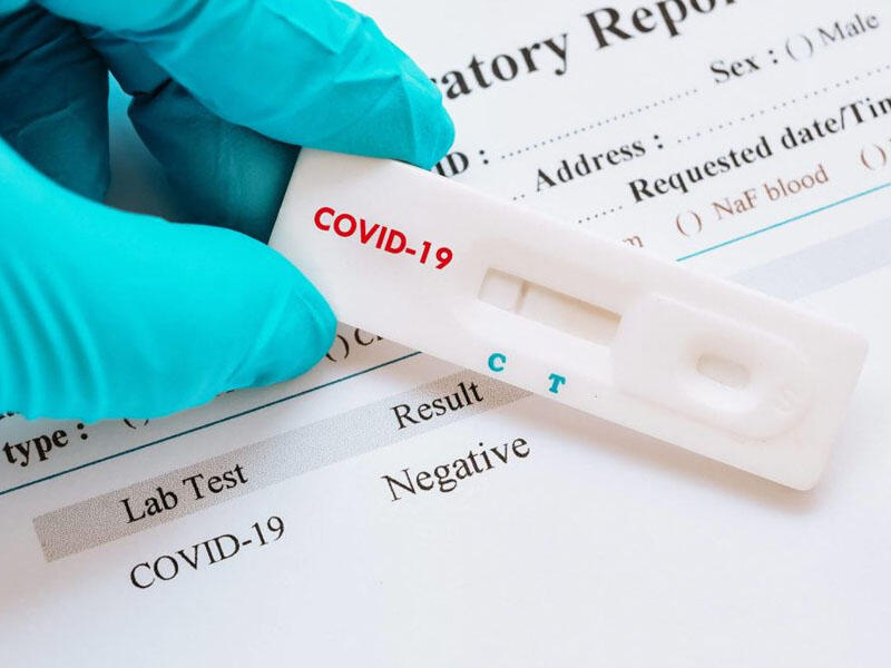 Apteklərdə satılan koronavirus testləri nə dərəcədə etibarlıdır? - TƏBİB açıqladı