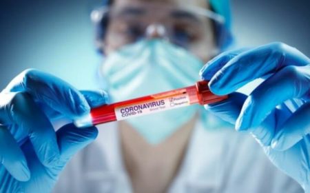 Azərbaycanda son sutkada 865 nəfər COVID-19-a yoluxub, 16 nəfər vəfat edib - FOTO