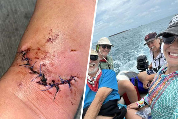 Женщина своими силами отбилась от напавшей на нее акулы