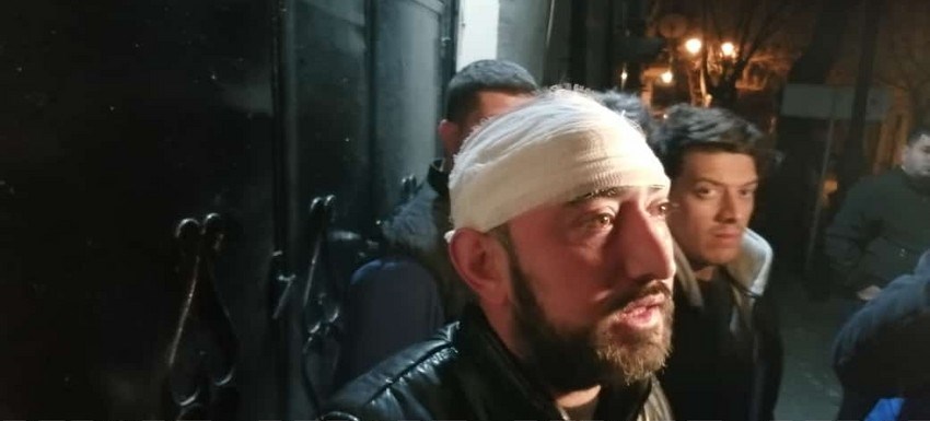 Bakıda gecə klubunda partlayış zamanı yaralananların bir qisminin adları məlum olub