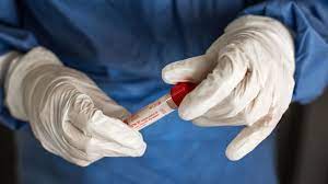 ABŞ-da koronavirusun mənşəyi ilə bağlı yeni araşdırma aparılıb