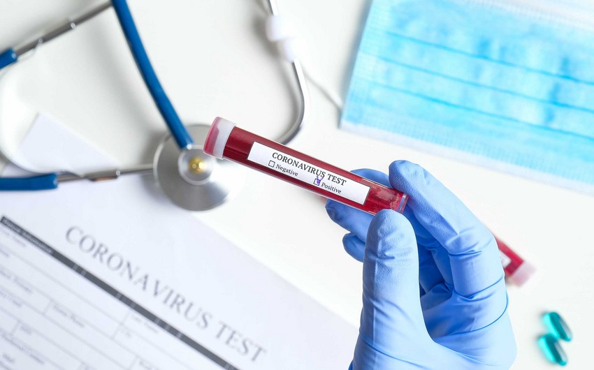 Azərbaycanda daha 36 nəfər COVID-19-a yoluxub, iki nəfər vəfat edib