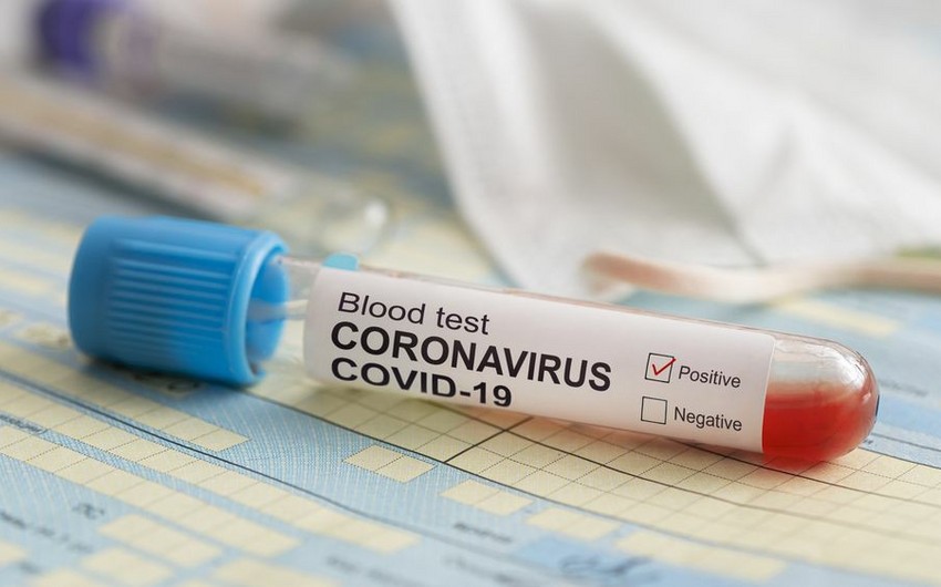 Azərbaycanda son sutkada 38 nəfər COVID-19-a yoluxub, bir nəfər vəfat edib - FOTO