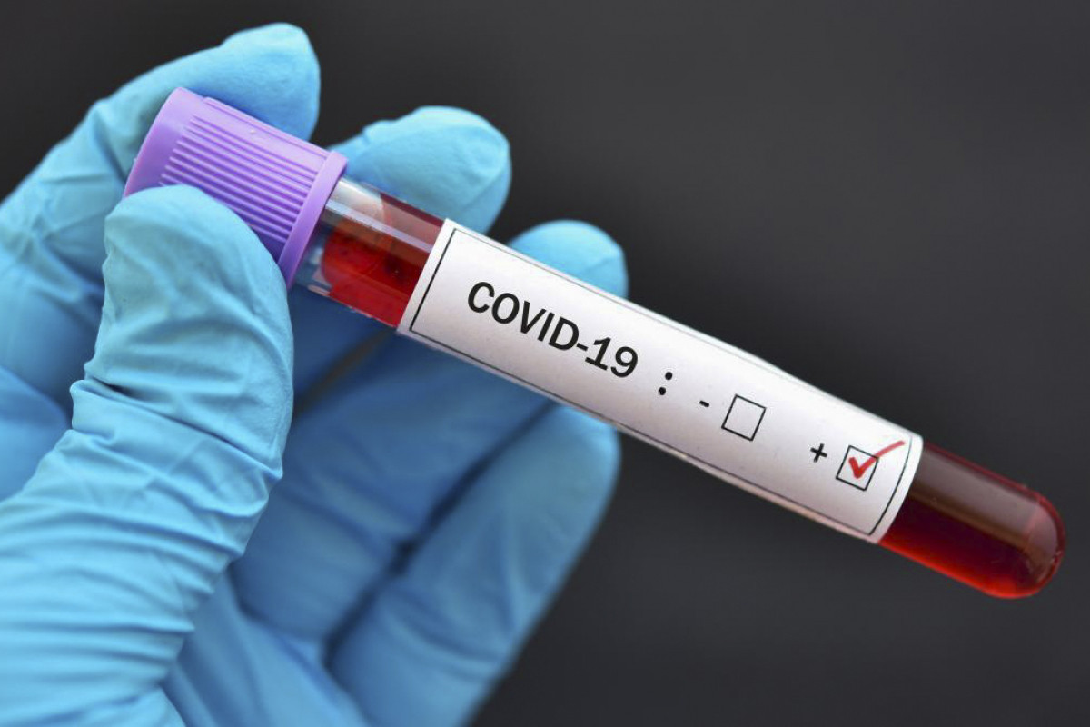 Gürcüstanda daha 115 nəfər COVID-19-a yoluxub, 3 nəfər ölüb