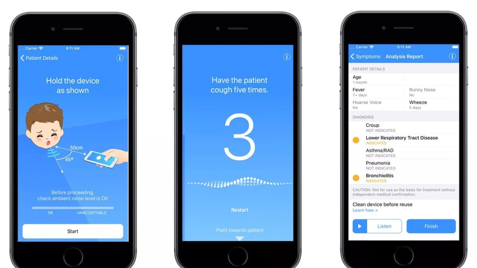 Öskürək səsindən “Covid-19” xəstəliyini aşkar edən mobil proqram hazırlanıb