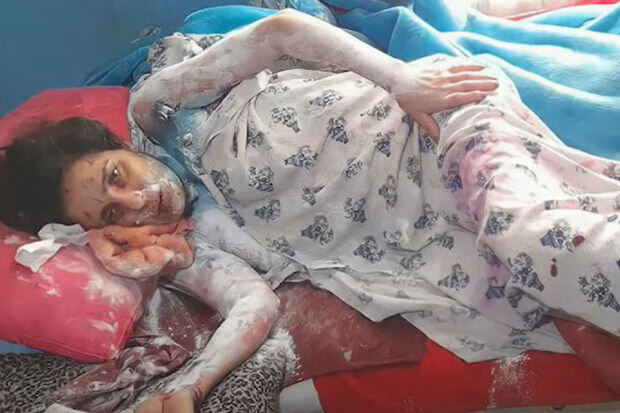 Azərbaycanda kişi gəlininin üzərinə kimyəvi maddə tökərək yandırdı - VİDEO