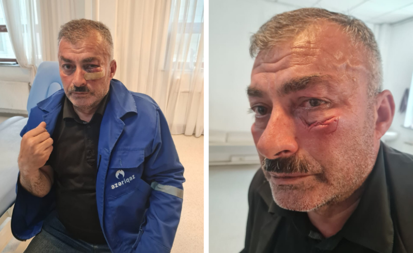 “Azəriqaz”ın əməkdaşına qarşı zor tətbiqi ilə bağlı cinayət işi başlanıb