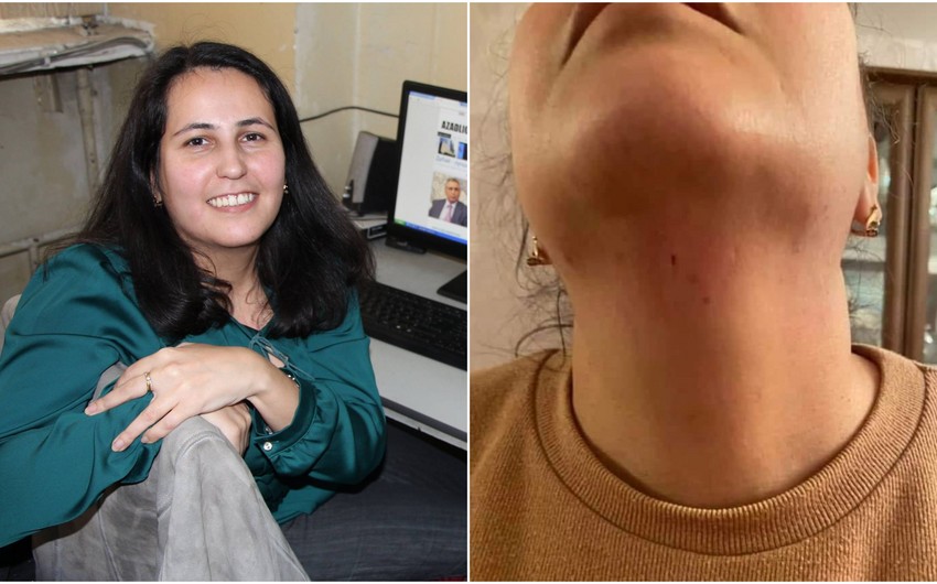 Jurnalist Aytən Məmmədovaya hücumla bağlı cinayət işi başlanılıb