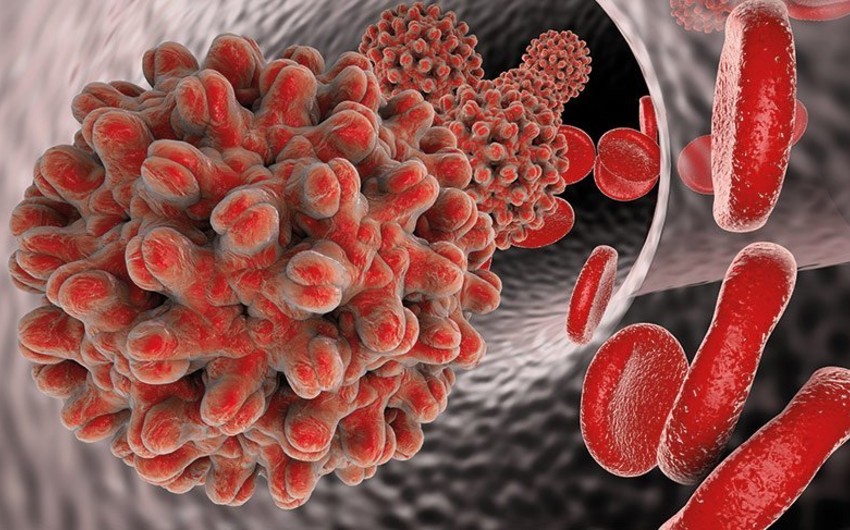 ÜST: 22 ölkədə naməlum mənşəli hepatit aşkarlanıb