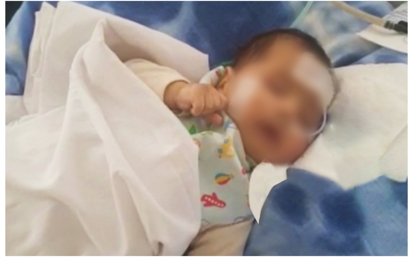 Bakıda bir həftə komada qalan 3 aylıq körpənin həyatı xilas edilib