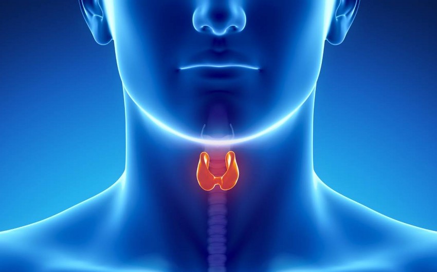 Azərbaycanda zob xəstəliyinin daha çox qeydə alındığı bölgələr açıqlanıb