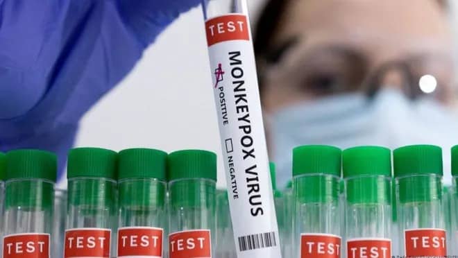 Almaniya meymunçiçəyi virusuna qarşı 240.000 doza peyvənd sifariş edib