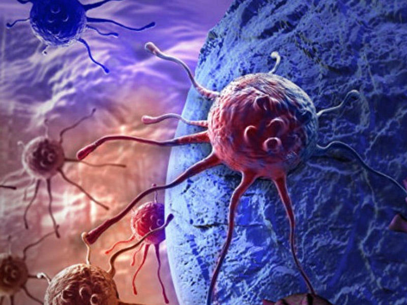 Çətin müalicə olunan xərçəng şişləri belə məhv ediləcək - YENİ KƏŞF