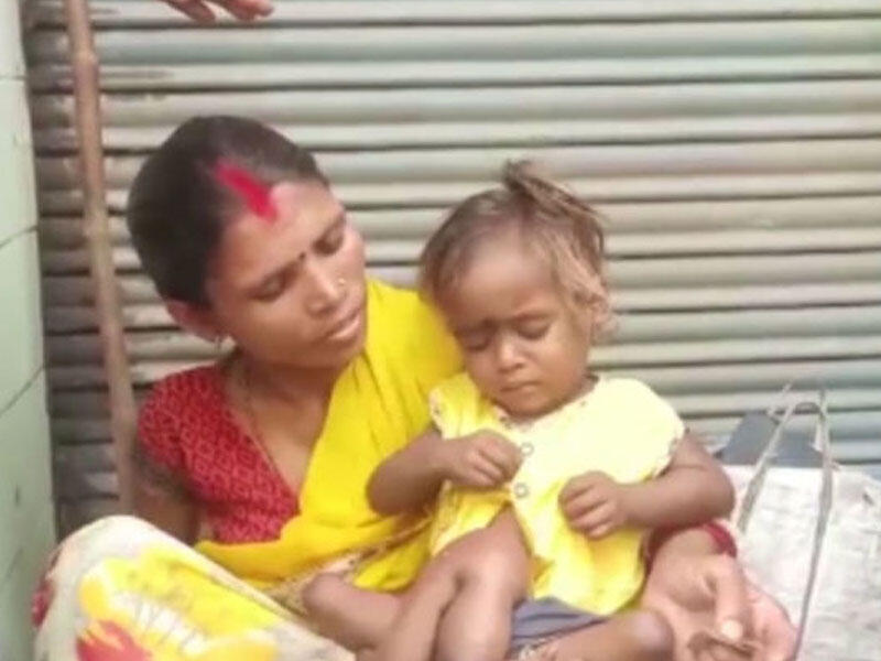 Dörd qolu və dörd ayağı olan “hörümçək qız” - VİDEO