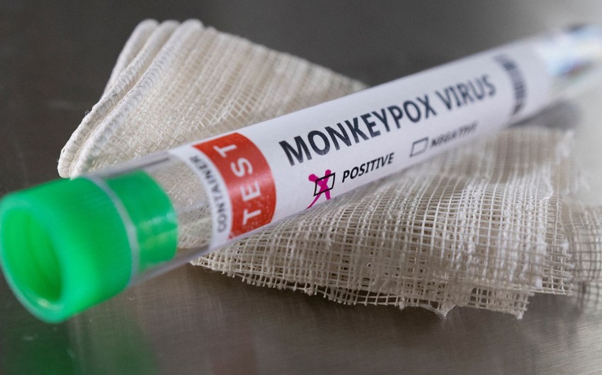 BƏƏ-də meymunçiçəyinə beş yeni yoluxma aşkarlanıb