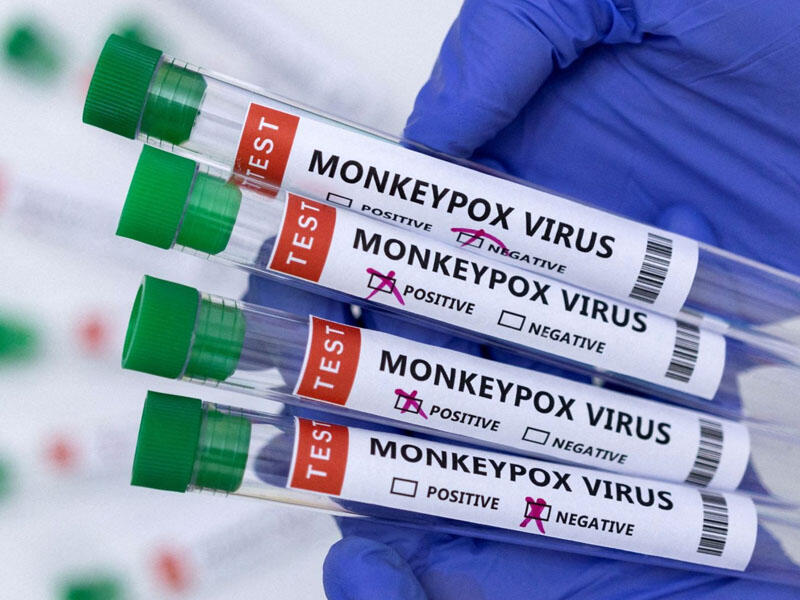 Bu ölkədə meymunçiçəyinə ilk yoluxma halı qeydə alındı