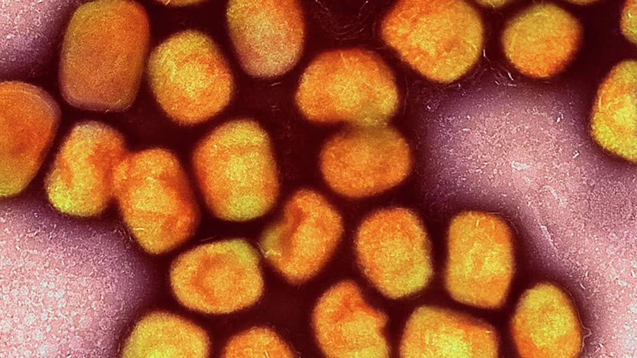 Venesuelada meymunçiçəyi virusuna ilk yoluxma halı qeydə alınıb