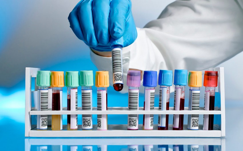 Son sutkada daha 19 nəfər koronavirusa yoluxub