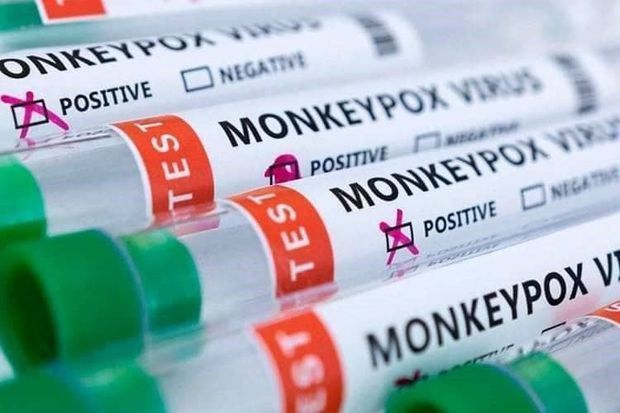 Rusiyada meymunçiçəyinə ilk yoluxma qeydə alınıb