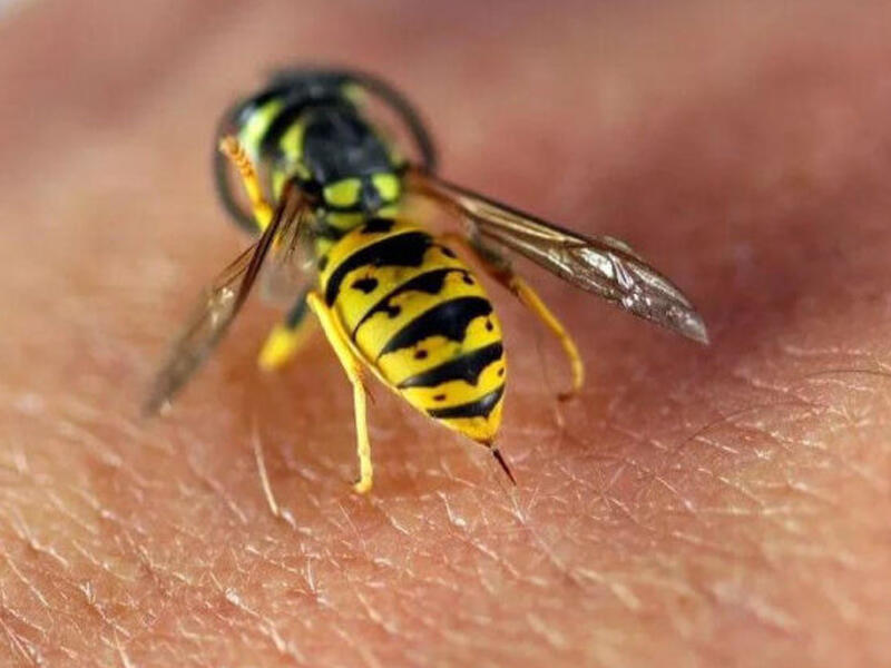 Arı sancmasına adi hal kimi yanaşmaq olmaz - XƏBƏRDARLIQ - VİDEO