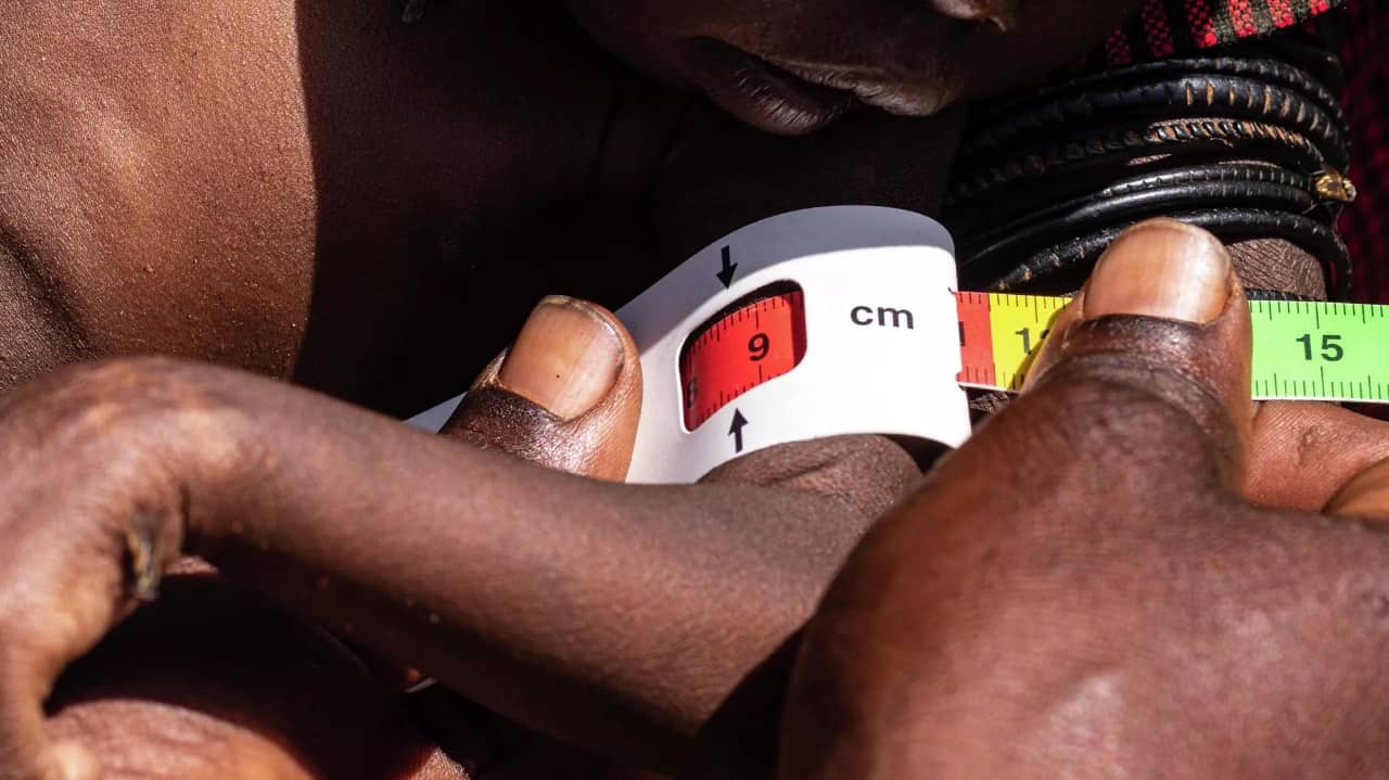 Uqandada aylardır davam edən quraqlıq: 46 NƏFƏR ÖLÜ