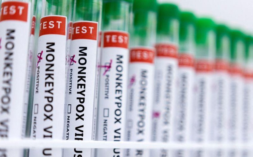 Fransada meymunçiçəyinə qarşı peyvənd mərkəzi açılıb