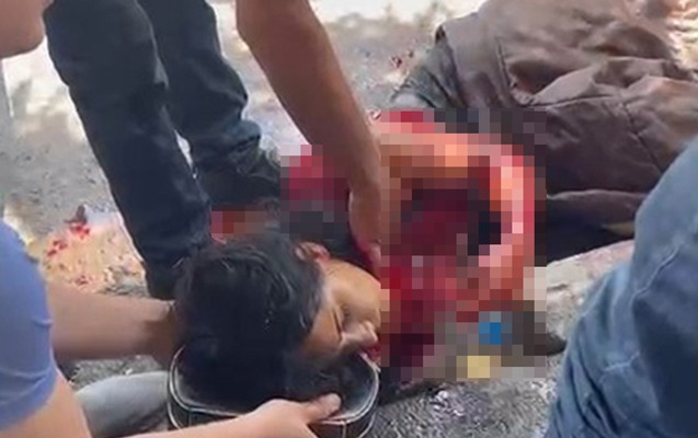 Sevgilisi 21 yaşlı qızı küçədə bıçaqladı