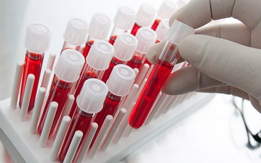 Son aylar Azərbaycanda hepatitlə bağlı müraciət edənlərin sayı açıqlanıb