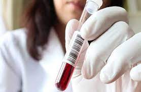 Kubada denqe qızdırmasına yoluxma halları artır