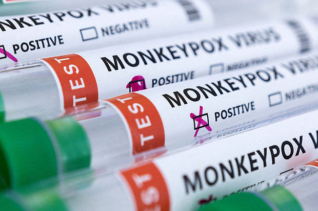 Britaniya alimləri meymunçiçəyinin “ədəbsiz” əlamətlərini açıqlayıblar