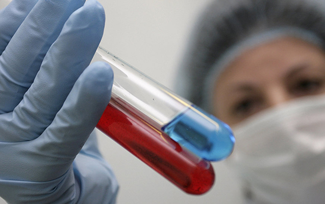 Azərbaycanda son sutkada 499 yeni yoluxma faktı qeydə alınıb