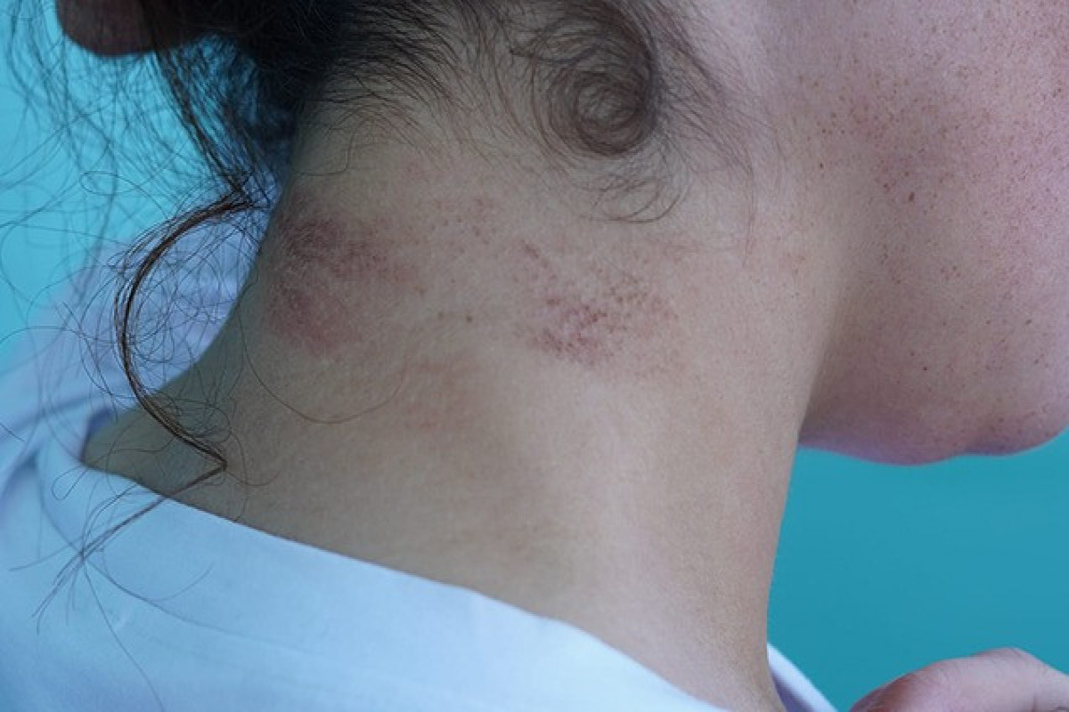 Yeznəsinə zorla ərə verilən qadınla bağlı açıqlama verilib