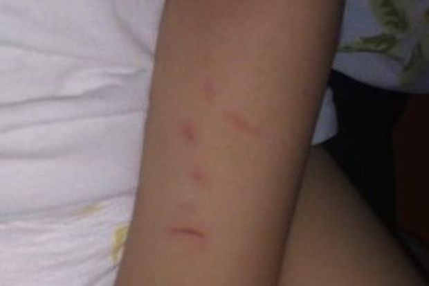 Bir yaşlı uşağın bağçada döyülməsi iddiası ilə bağlı RƏSMİ AÇIQLAMA - YENİLƏNİB + FOTO