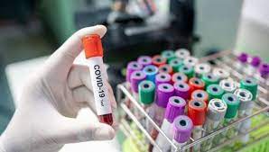 Dünyada COVID-19-a yoluxanların sayı 624 milyon nəfəri ötüb