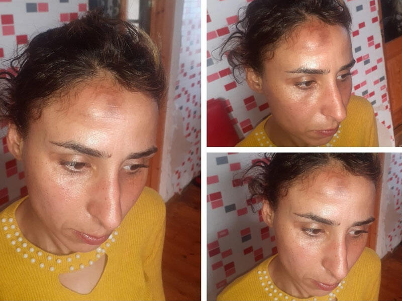 Avtobusda dava düşdü, tibb bacısı qadını döydü