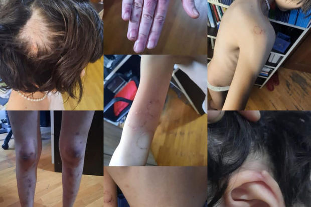 DİN-dən hamilə qadının və 13 yaşlı qızın döyülməsinə REAKSİYA - FOTO