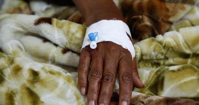 Nigeriyada vəba epidemiyasında ölənlərin sayı 382 nəfərə çatıb