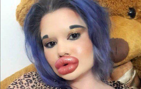 Dünyanın ən böyük dodaqları olan qadın rekorda cəhd edəcək