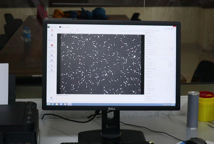 Azərbaycanda ilk dəfə düyələrə uğurlu embrion transferi həyata keçirilib