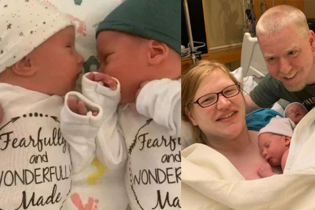 Yeni dünya rekordu: 31 yaşlı əkizlər dünyaya gəldi - FOTO