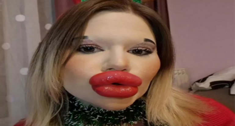 22 min dollar xərclədi, belə oldu: 