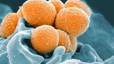 Fransada “Strep A” bakteriyasından 3 NƏFƏR ÖLDÜ