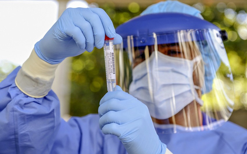 Son sutkada Azərbaycanda 81 nəfər koronavirusa yoluxub