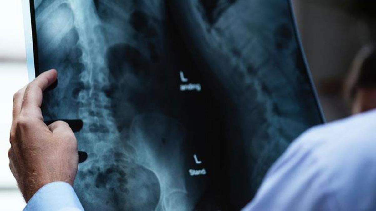 Uşağı kəskin ağrılarla xəstəxanaya apardılar – Müayinə nəticələri həkimləri təəccübləndirdi - FOTO