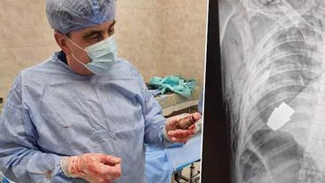 Ukrayna əsgərinin cəsədindən əl qumbarası çıxarılıb